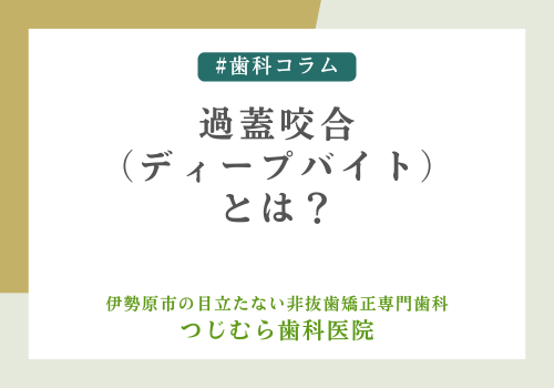 過蓋咬合（ディープバイト）とは？